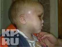 Жорстоко побитий малюк_1