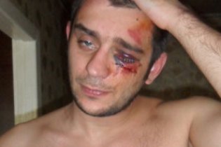 Побитий міліцією донецький журналіст заявив про провокацію