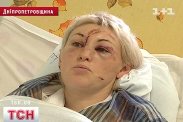 Постраждалі
